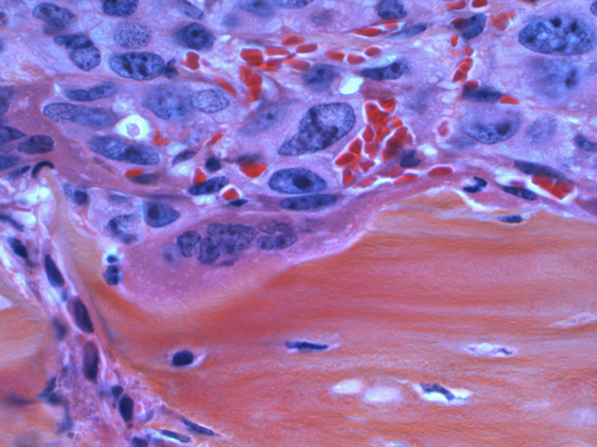 Cancer Screening Programmes 